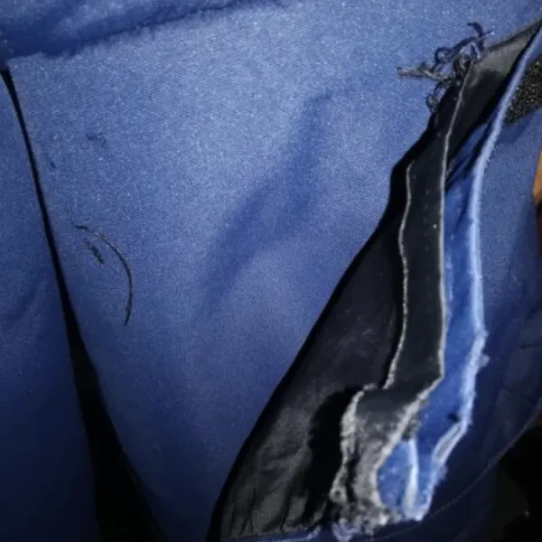 Coat pocket repair fail